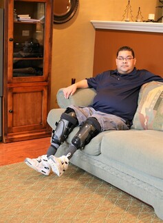 Prosthesis home fitting