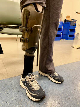 The iFIT Transtibial Prosthesis - iFIT Prosthetics